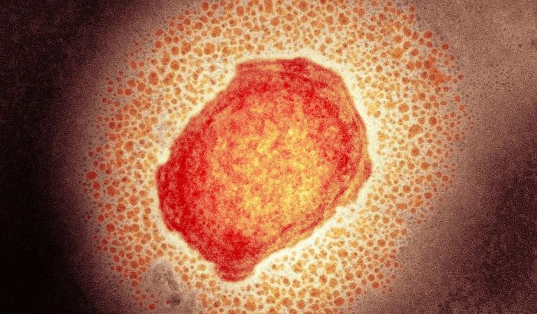 Microscopisch beeld van het apenpokkenvirus